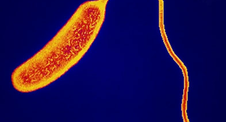 В Мариуполе растет число носителей холеры