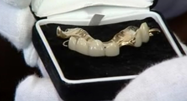 Челюсть Черчилля продали за 23,5 тыс. долларов