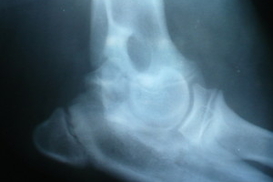 Из-за травмированных киевлян возбуждено уже 7 уголовных дел