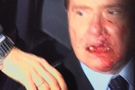 Берлускони получил статуэткой по лицу (ФОТО)