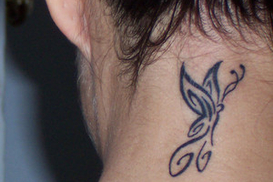 Бельгийка, сделавшая татуировку, впала в кому