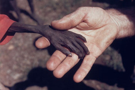 ООН призывает всех людей поголодать один день