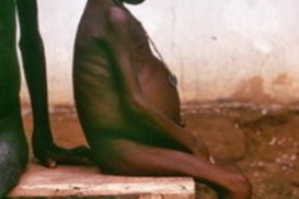 В мире изобилия и достатка 854 млн. человек голодает – ООН