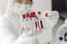 Немцы будут платить за тесты на COVID-19 сами – решение властей