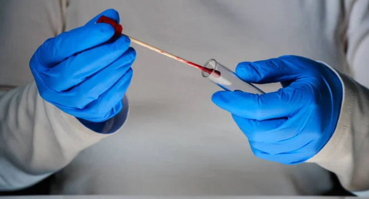 Иллюстративное фото / depositphotos.com